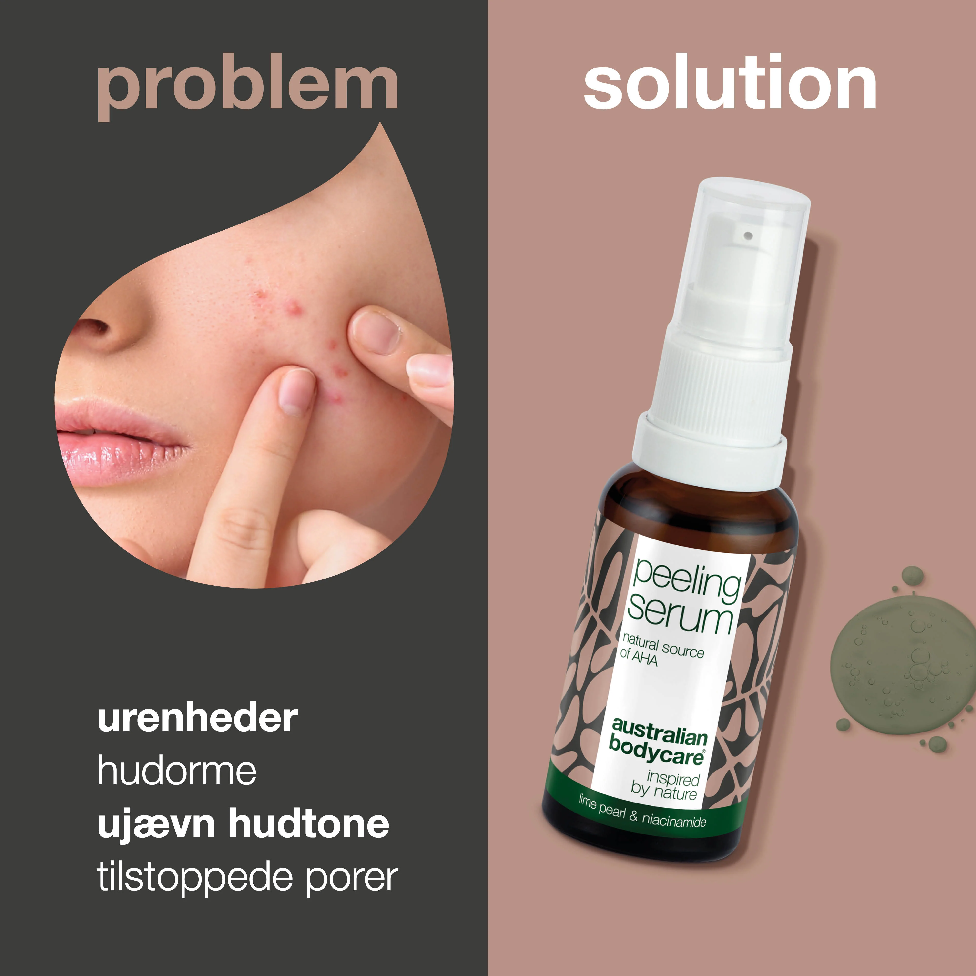 AHA Peeling Serum â Eksfoliering for glattere og friskere hud â AHA Peeling Serum fjerner døde hudceller, udjĂŚvner hudens tekstur og giver en sund glød. Med Lime Pearl, Niacinamid og Allantoin. - Image 2