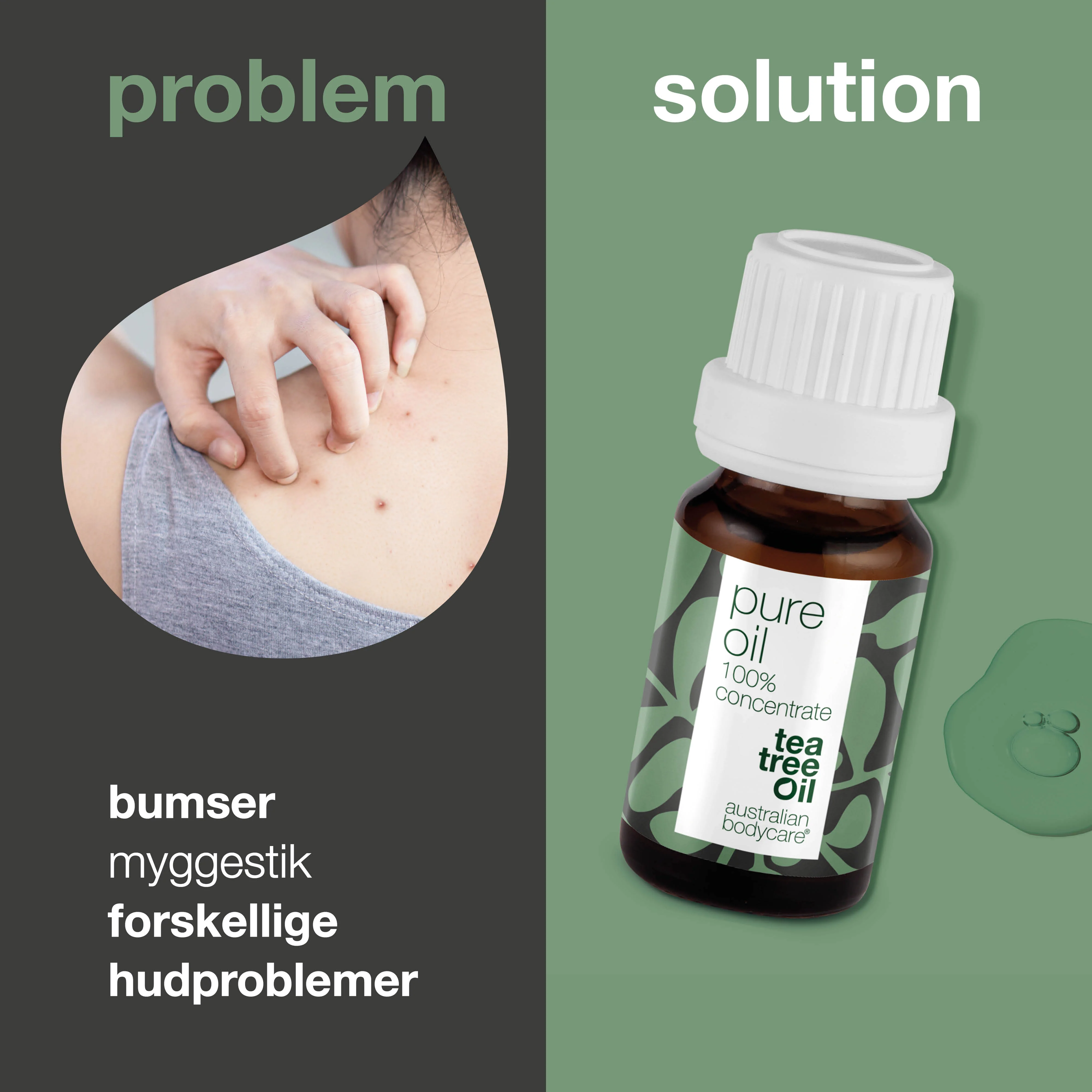 Koncentreret Tea Tree Oil til hudproblemer —  100% naturlig og ufortyndet Tea Tree Oil fra Australien - Image 2
